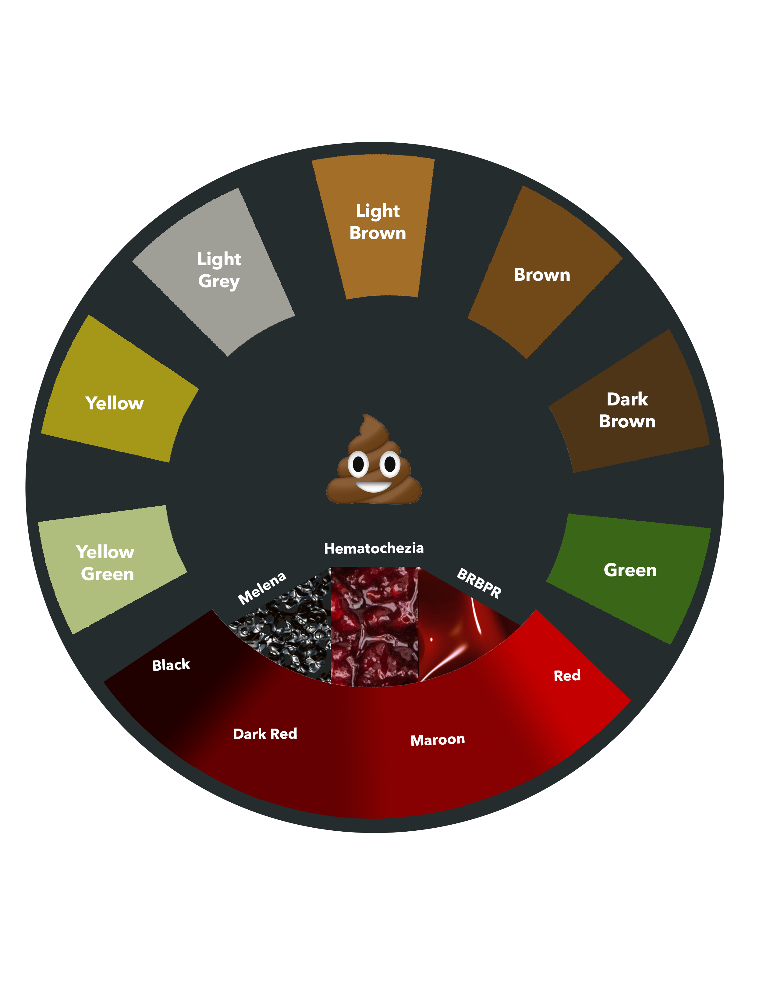 Blood In Stools Melena Causes Symptoms Diagnosis Trea - vrogue.co